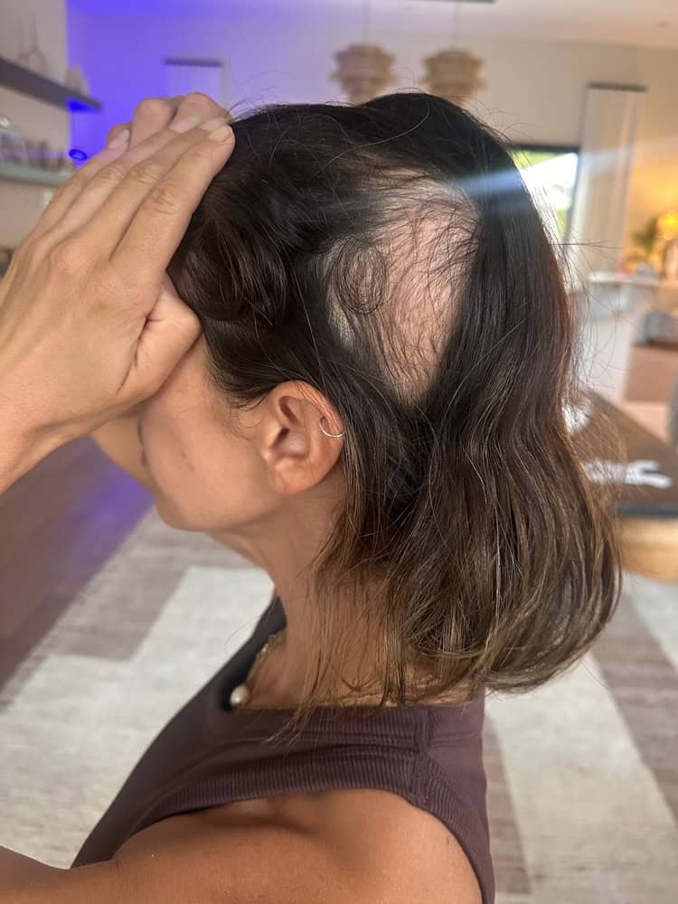 Before and after hair topper transformation at Delray Beach FL salon