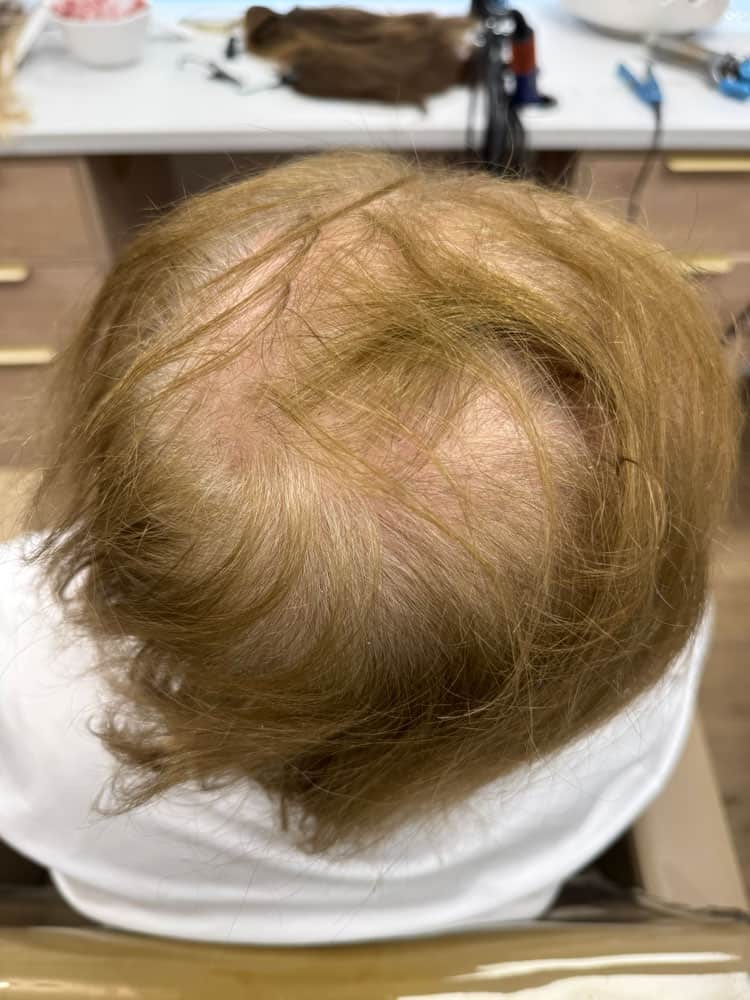 Real client hair topper transformation before and after in Delray Beach Florida