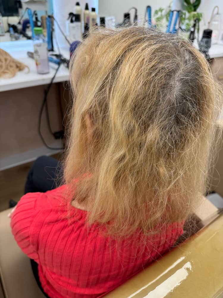 Hair loss solution before and after with premium hair topper in Delray Beach FL